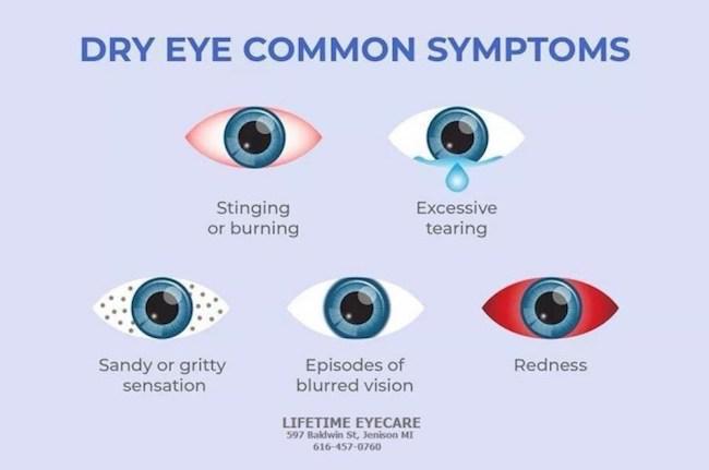 dry eye symptoms